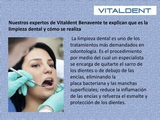 limpieza dental vitaldent|Vitaldent